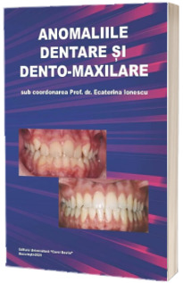 Anomaliile dentare si dento-maxilare