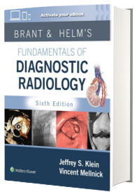 Brant and Helm s Fundamentals of Diagnostic Radiology: Print + eBook with Multimedia