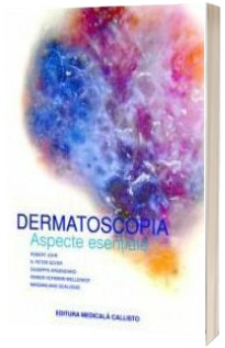 Dermatoscopia. Aspecte Esentiale