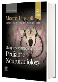 Diagnostic Imaging: Pediatric Neuroradiology