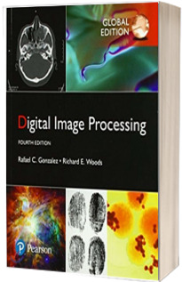 Digital Image Processing, Global Edition