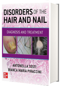 Disorders of the Hair and Nail: Diagnosis and Treatment