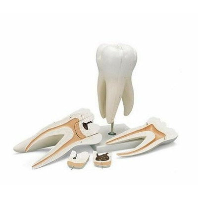 Molar superior cu radacina tripla. Marit la scara 15,1. Model compus din 6 parti.