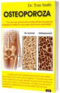 Osteoporoza (Smith, Tom)