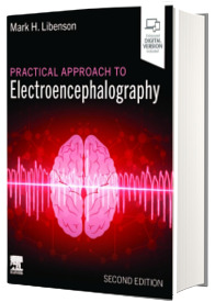 Practical Approach to Electroencephalography