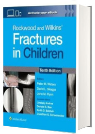 Rockwood and Wilkins Fractures in Children: Print + eBook with Multimedia