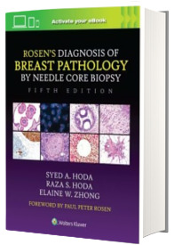 Rosen s Diagnosis of Breast Pathology by Needle Core Biopsy