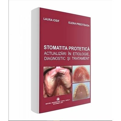 Stomatita protetica. Actualizari in etiologie, diagnostic si tratament