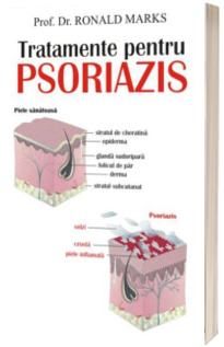 Tratamente pentru psoriazis