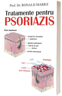 Tratamente pentru psoriazis